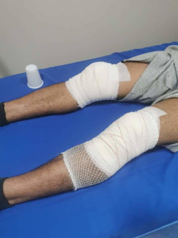 Ocho marroquies menores de edad le pegan una paliza a un joven por defender a unas chicas