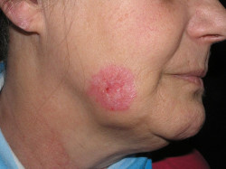 Realizan el primer atlas de las enfermedades autoinmunes y autoinflamatorias