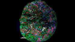 Revelan por primera vez el comportamiento de los anticuerpos terap&eacute;uticos en la inmunoterapia contra el c&aacute;nc