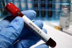 Sanidad resalta que los tratamientos en fase avanzada de hepatitis C se han reducido del 62% al 29% desde 2016