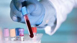 Un análisis de sangre detecta tumores infantiles en función de sus perfiles epigenéticos