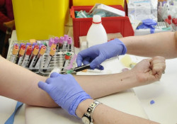 Un análisis de sangre predice el riesgo de enfermedad cardiovascular en las mujeres 30 años antes