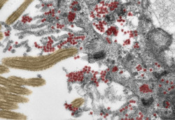  Un estudio evidencia que el coronavirus llega al cerebro a trav&eacute;s de la nariz