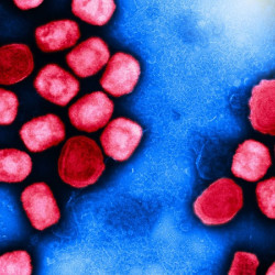 Un estudio identifica las mutaciones de la viruela del mono que hacen al virus infeccioso