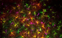 Un grupo reducido de c&eacute;lulas interviene en la p&eacute;rdida de memoria por cannabis en adolescentes