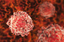 Un medicamento experimental logra curar la leucemia avanzada en 18 pacientes