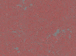 Un nuevo estudio revela un `tal&oacute;n de Aquiles` de c&eacute;lulas cancerosas y arroja luz sobre un misterio de 140 a&ntilde;os