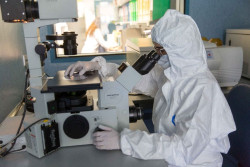Un tipo de c&eacute;lulas del tumor puede ayudar a predecir qu&eacute; pacientes responden mejor a inmunoterapia, seg&uacute;n un estudio