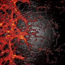 Un tratamiento preventivo inyectable reduce las complicaciones de la retinopat&iacute;a diab&eacute;tica