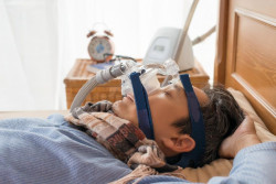 Uso de CPAP en apnea del sueño puede proteger el corazón en pacientes de alto riesgo, pero aumentarlo en otros